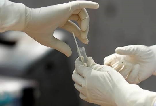 Hukum Ujian Swab Untuk Saringan Covid-19 Terhadap Orang Berpuasa